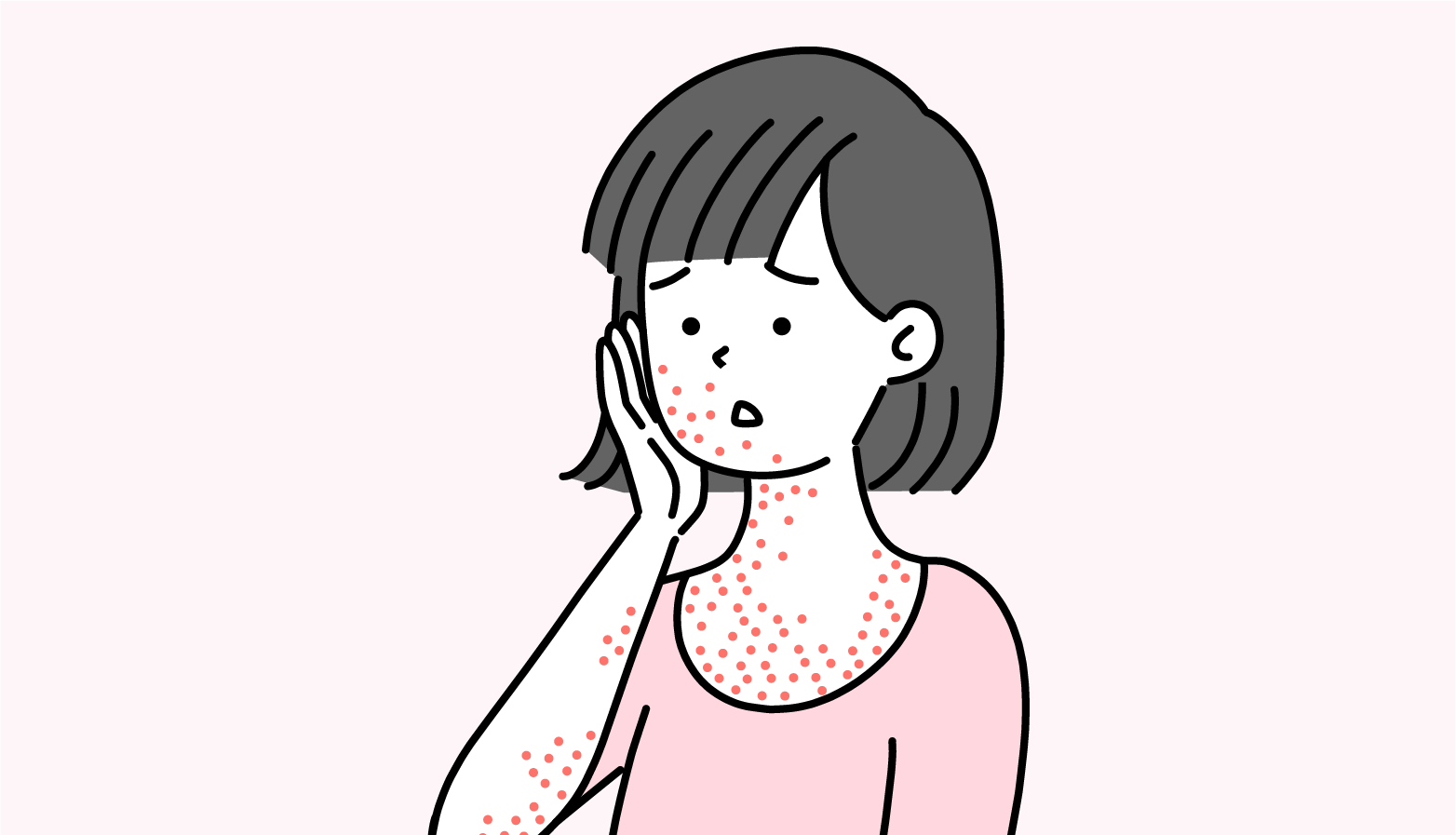 アトピー性皮膚炎｜原因・症状・治療法・スキンケア・生活改善を皮膚科医が解説のイメージ画像