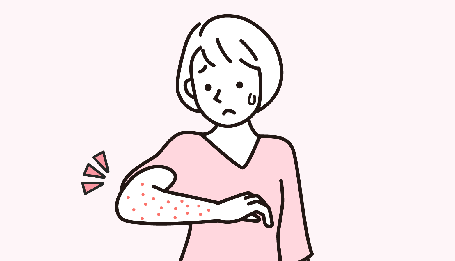 蕁麻疹について｜原因・症状・治療法・検査・予防を皮膚科医が解説のイメージ画像